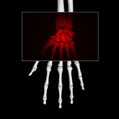 Остеопения и остеопороз