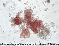 Геморрагический диатез